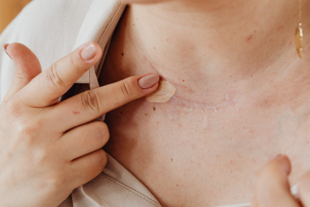 Mulher usando corretivo na pele